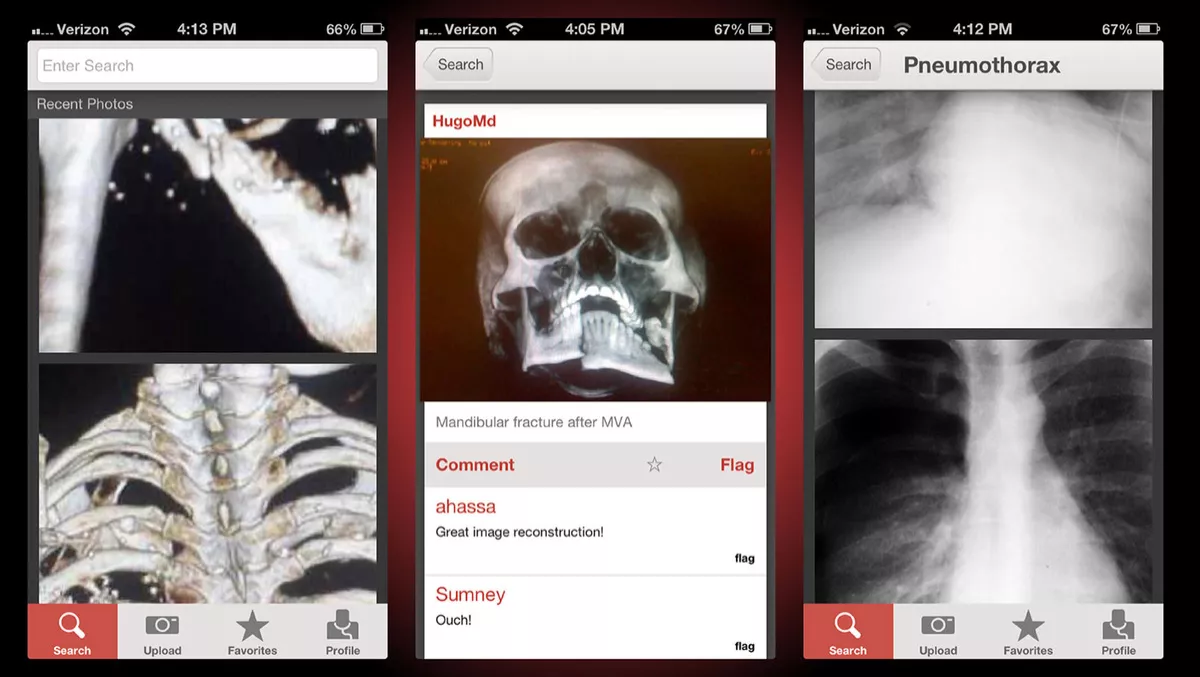 New learning tool for healthcare professionals